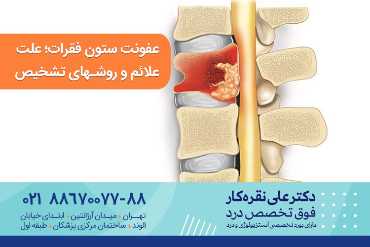 عفونت ستون فقرات