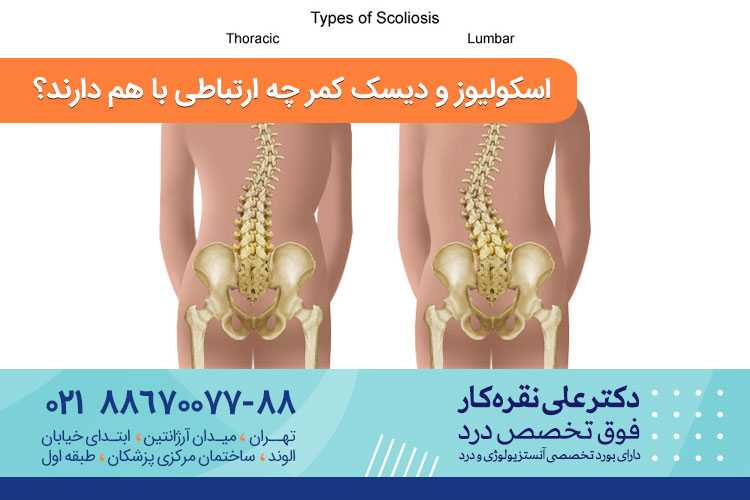 اسکولیوز و دیسک کمر