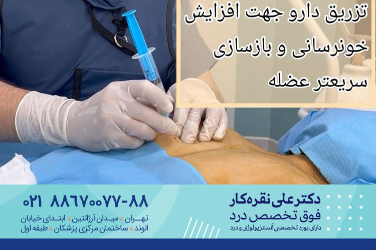 تزریق گره عضلانی