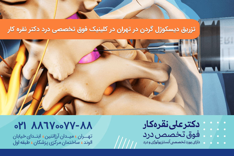 دیسکوژل گردن چیست