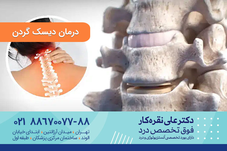 درمان دیسگ گردن