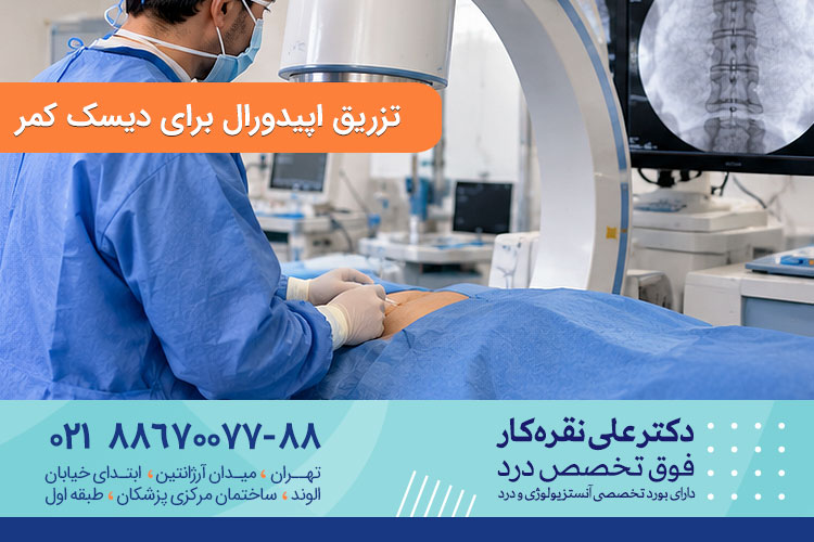 تزریق اپیدورال برای دیسک کمر