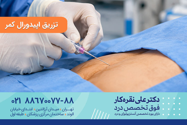 تزریق اپیدورال کمر
