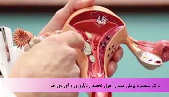 فیبروم رحمی ( بخش اول )