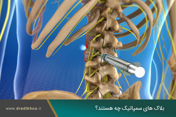 بلاک های سمپاتیک