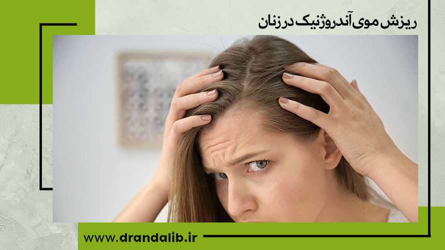 ریزش موی آندروژنیک در زنان