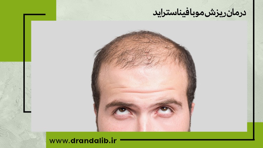 درمان ریزش مو با فیناستراید