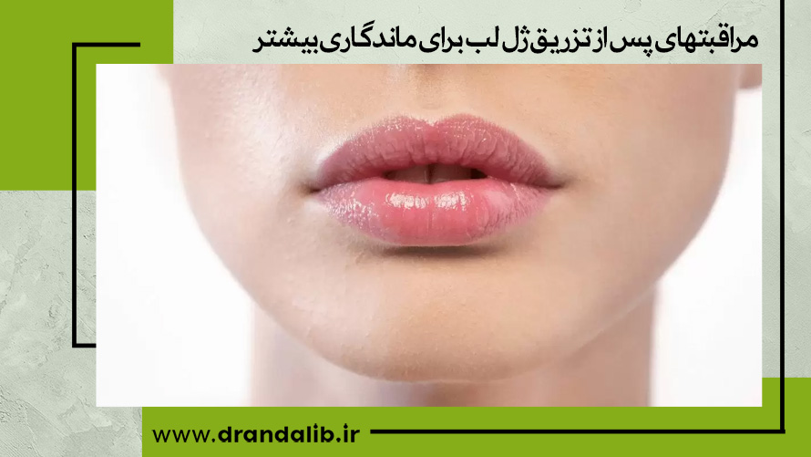 مراقبتهای پس از تزریق ژل لب