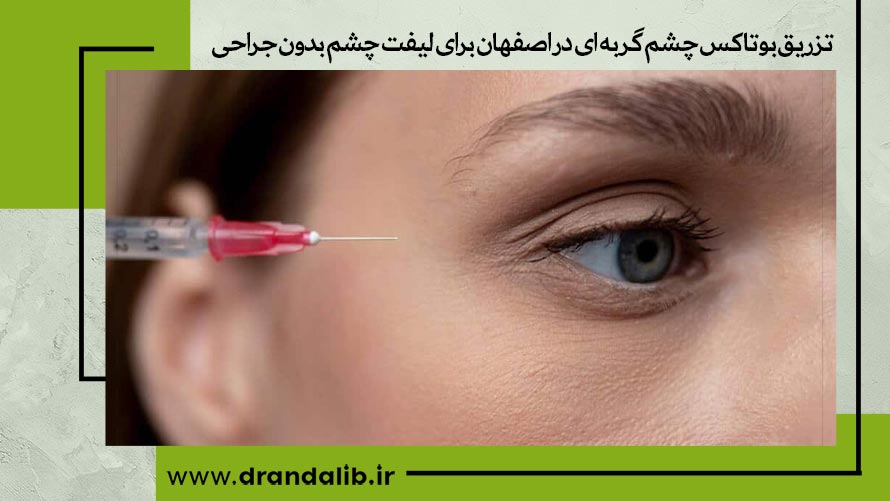 تزریق بوتاکس چشم گربه ای 
