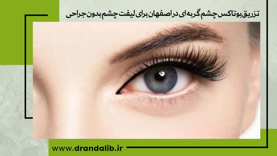 تزریق بوتاکس چشم گربه ای در اصفهان 