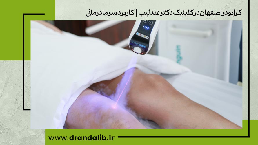 کرایو در اصفهان در کلینیک دکتر عندلیب