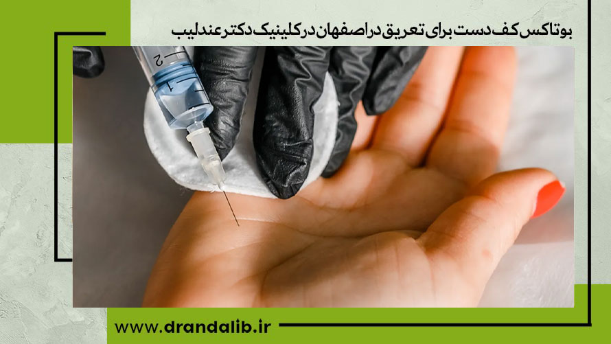 بوتاکس کف دست