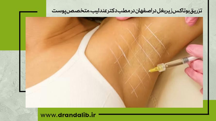 تزریق بوتاکس زیر بغل در اصفهان