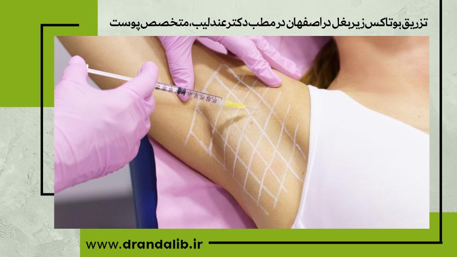 بوتاکس زیر بغل در اصفهان