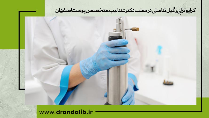 کرایوتراپی زگیل تناسلی در اصفهان