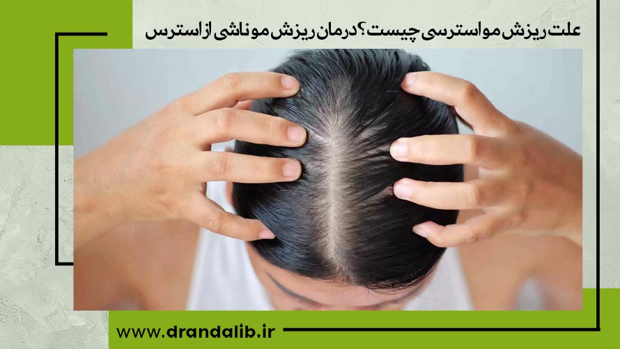 ریزش موی ناشی از استرس چیست؟