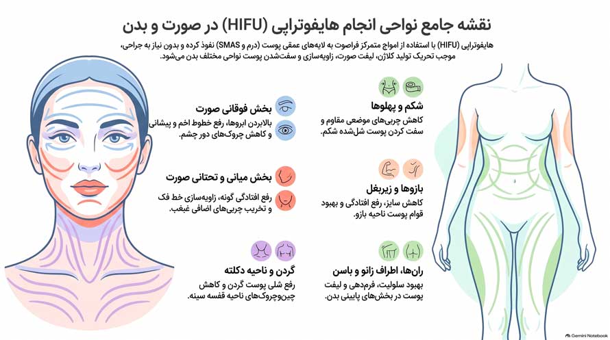 نواحی انجام هایفوتراپی