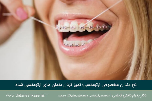 نخ دندان مخصوص ارتودنسی
