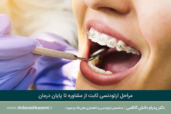 مراحل ارتودنسی به ترتیب