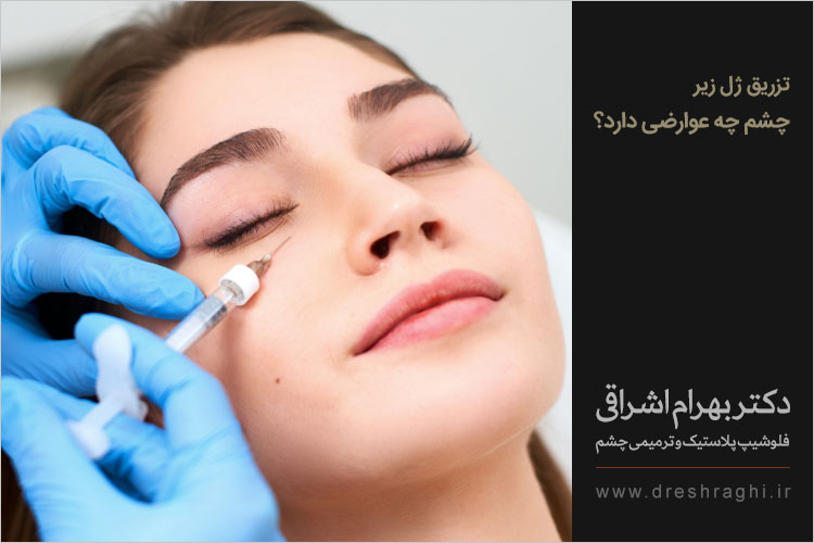 عوارض تزریق ژل زیر چشم