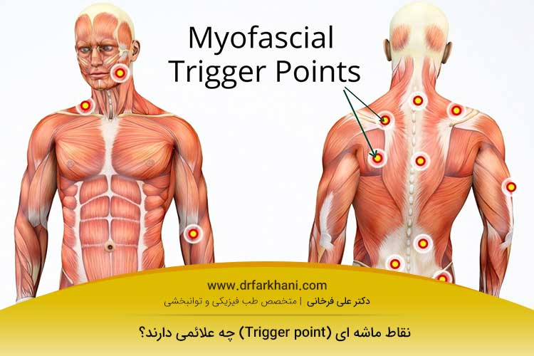 عکس نقاط ماشه ای