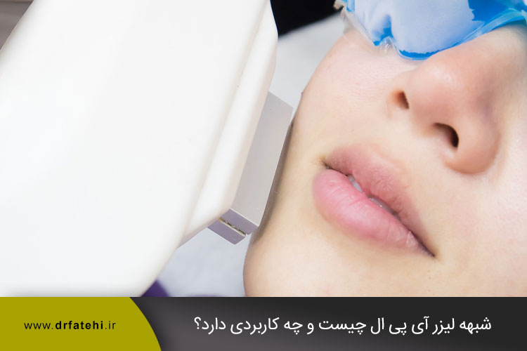 دستگاه آی پی ال IPL