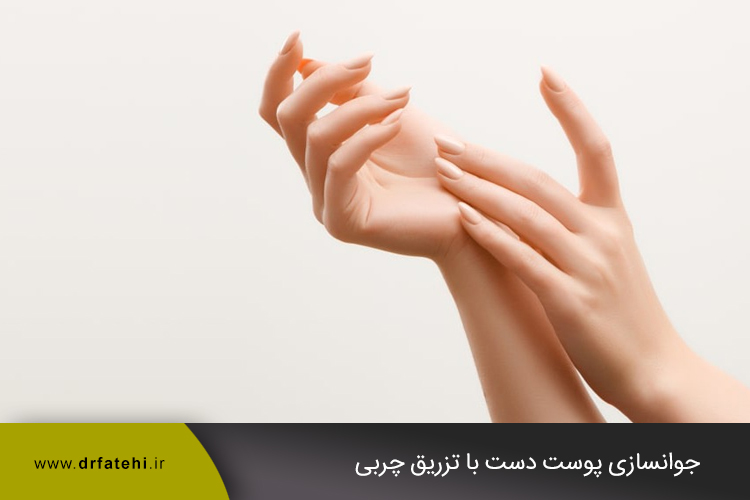 جوانسازی پوست دست با تزریق چربی