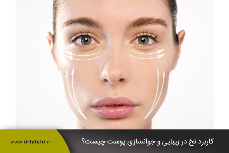 کاربرد نخ در زیبایی و جوانسازی پوست