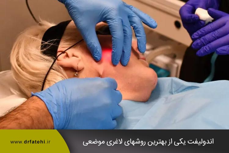 اندولیفت یکی از بهترین روشهای لاغری موضعی