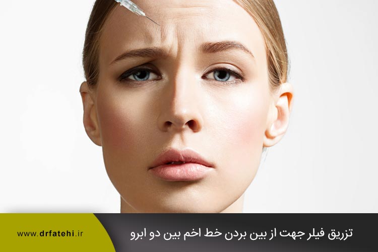 تزریق فیلر جهت از بین بردن خط اخم بین دو ابرو