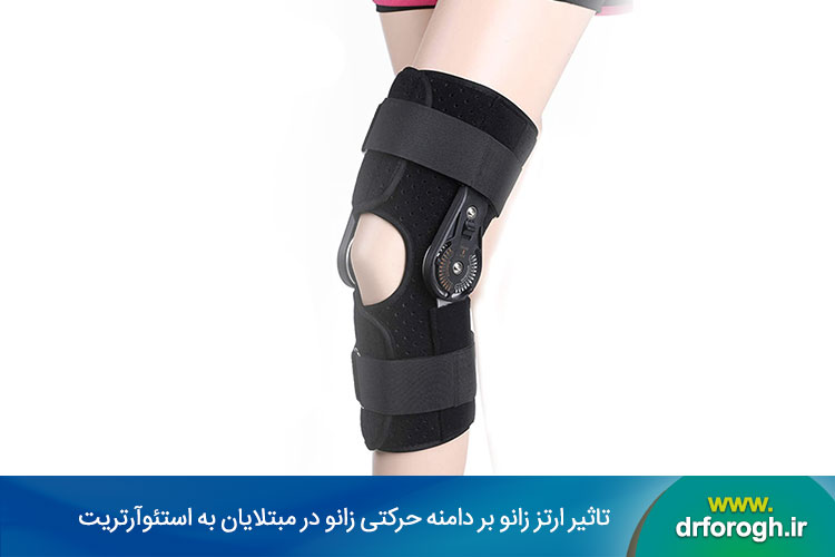 استئوآرتریت زانو