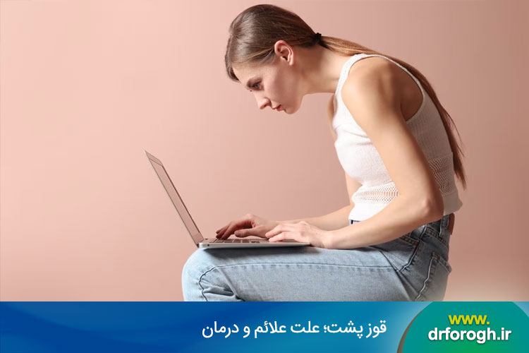علت و علائم قوز پشت 