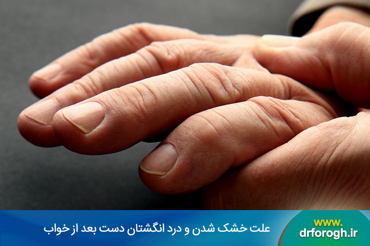 علت خشک شدن و درد انگشتان دست بعد از خواب