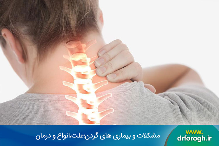 مشکلات و بیماریهای گردن