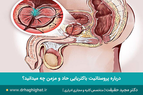 پروستاتیت باکتریایی