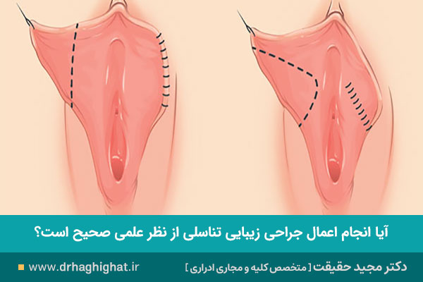 جراحی زیبایی تناسلی