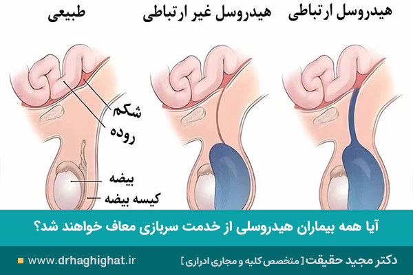 هیدروسل و معافیت از سربازی