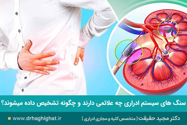 تشخیص سنگ ادراری و علائم