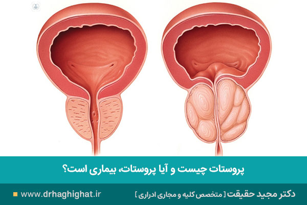 غده پروستات