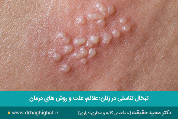 تبخال تناسلی زنان