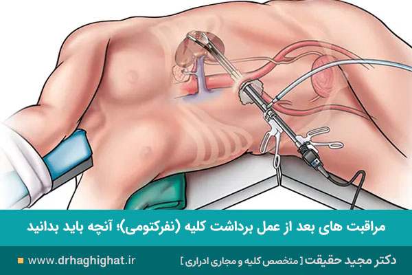 مراقبت های بعد ا زنفرکتومی