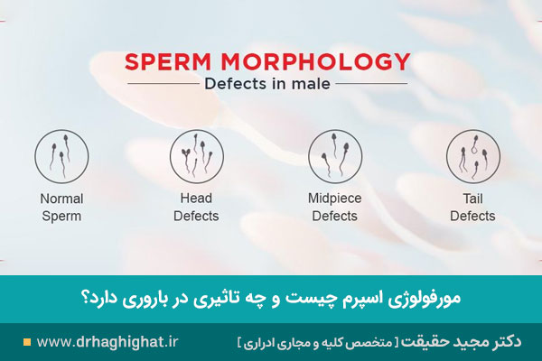 مورفولوژی اسپرم چیست؟