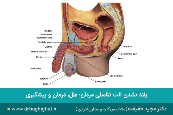 بلند نشدن آلت تناسلی مردان