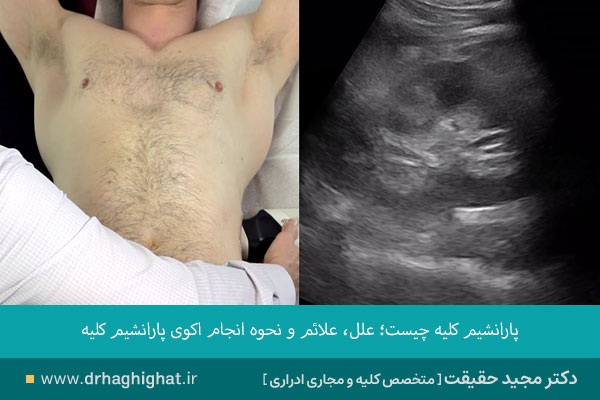 اکوی پارانشیم کلیه