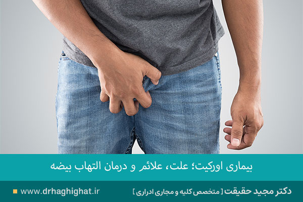 اورکیت بیضه