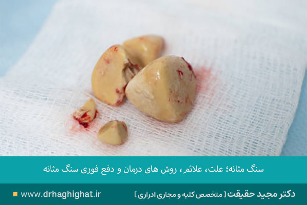 عکس سنگ مثانه