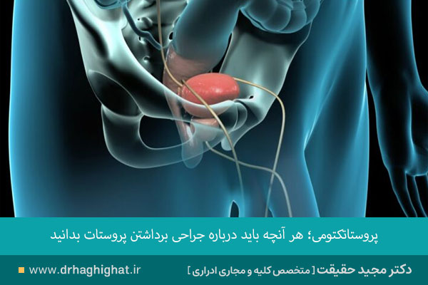 پروستاتکتومی