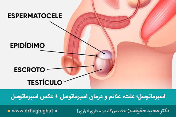 اسپرماتوسل 