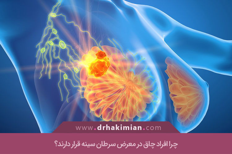 ارتباط وزن بدن با سرطان پستان