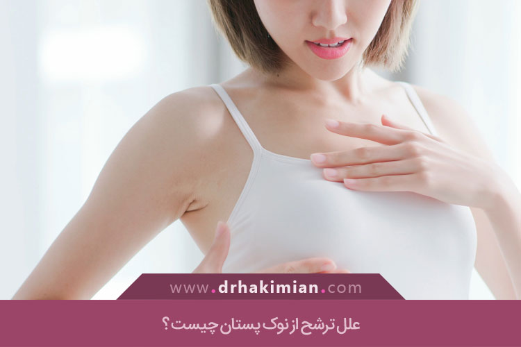 علل ترشح از نوک پستان